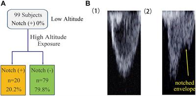 The Association Between Notching of the Right Ventricular Outflow Tract Flow Velocity Doppler Envelope and Impaired Right Ventricular Function After Acute High-Altitude Exposure